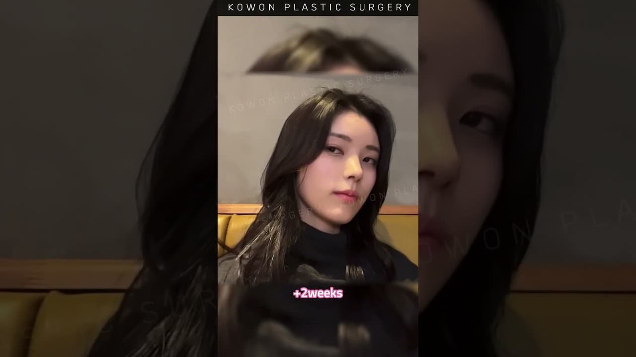 낮은코 매부리코 동시에 수술했더니?