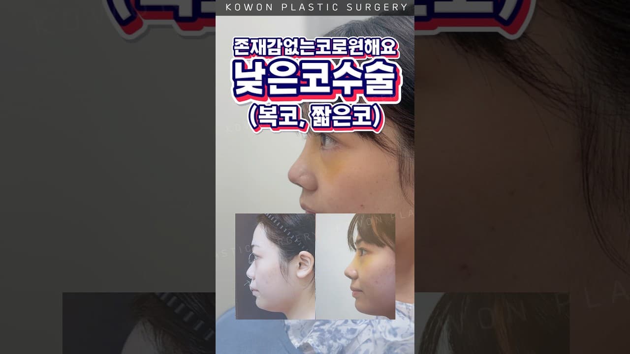 짧은코+복코, 자연스럽게 높아진다면?