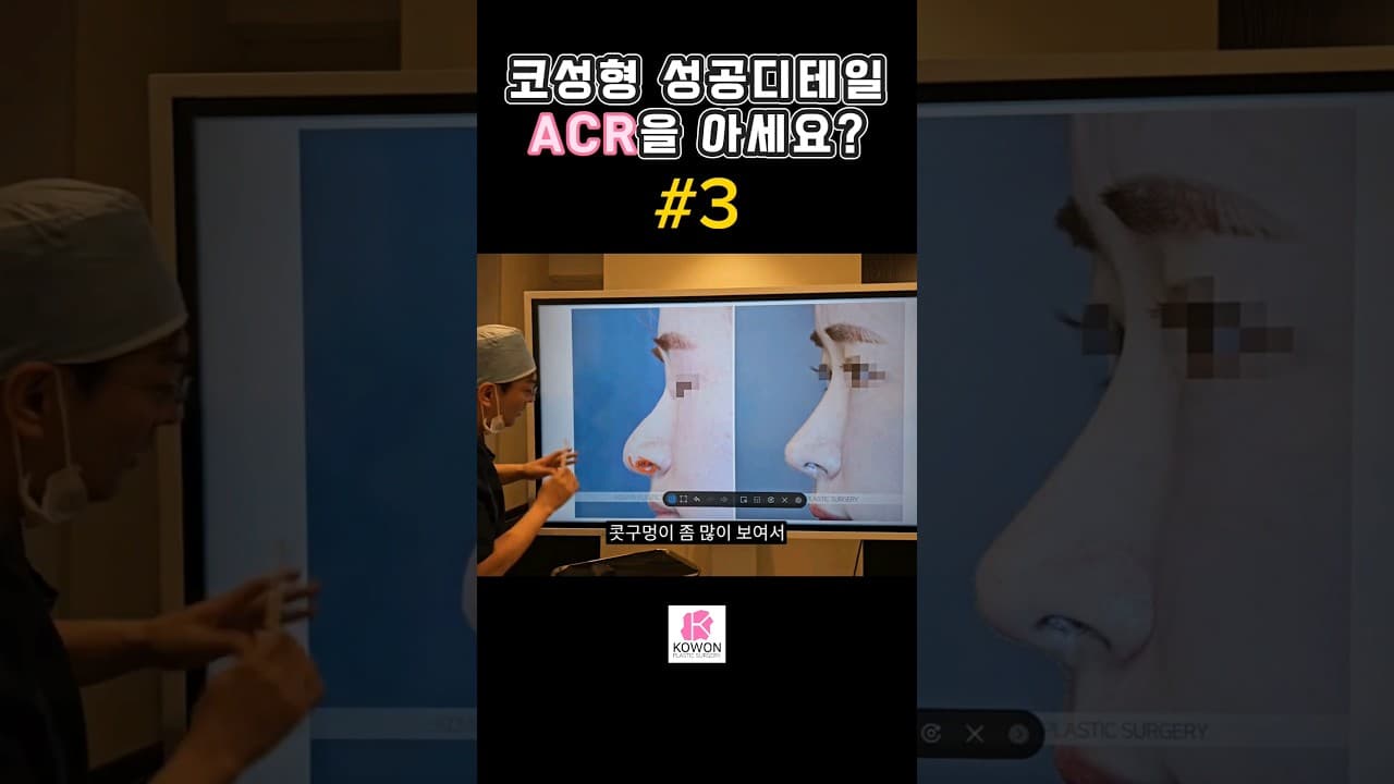 Part.3 코성형성공디테일, ACR을 아십니까? 비주와 비순각라인 , 코모양과 입술모양의 관계
