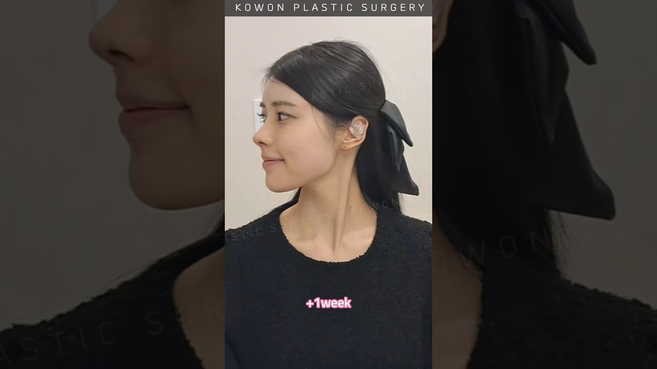 낮은코 매부리코가 고민이었어요