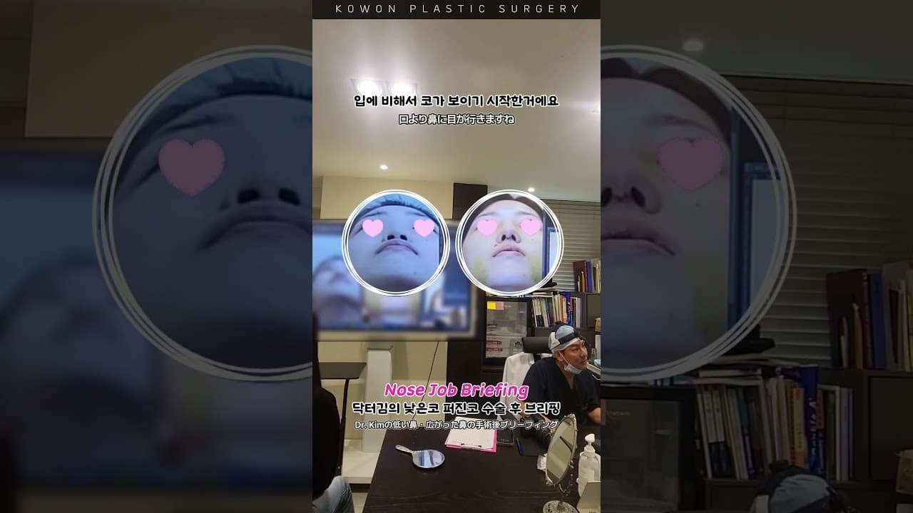 Part.2_낮은코 퍼진코 수술 후 브리핑코 (수술했더니 입매가 예뻐졌다?) #nosejob #整形