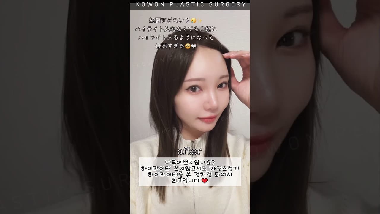 이마필러Vlog | K뷰티여행day (옆모습의 before→after 너무 달라😂)