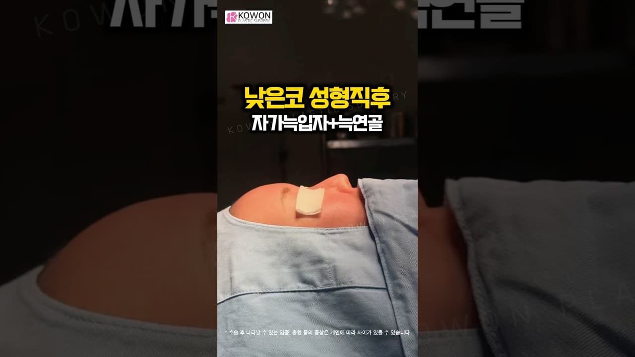 낮은코 코수술 직후, 자가늑입자로 이렇게 달라집니다