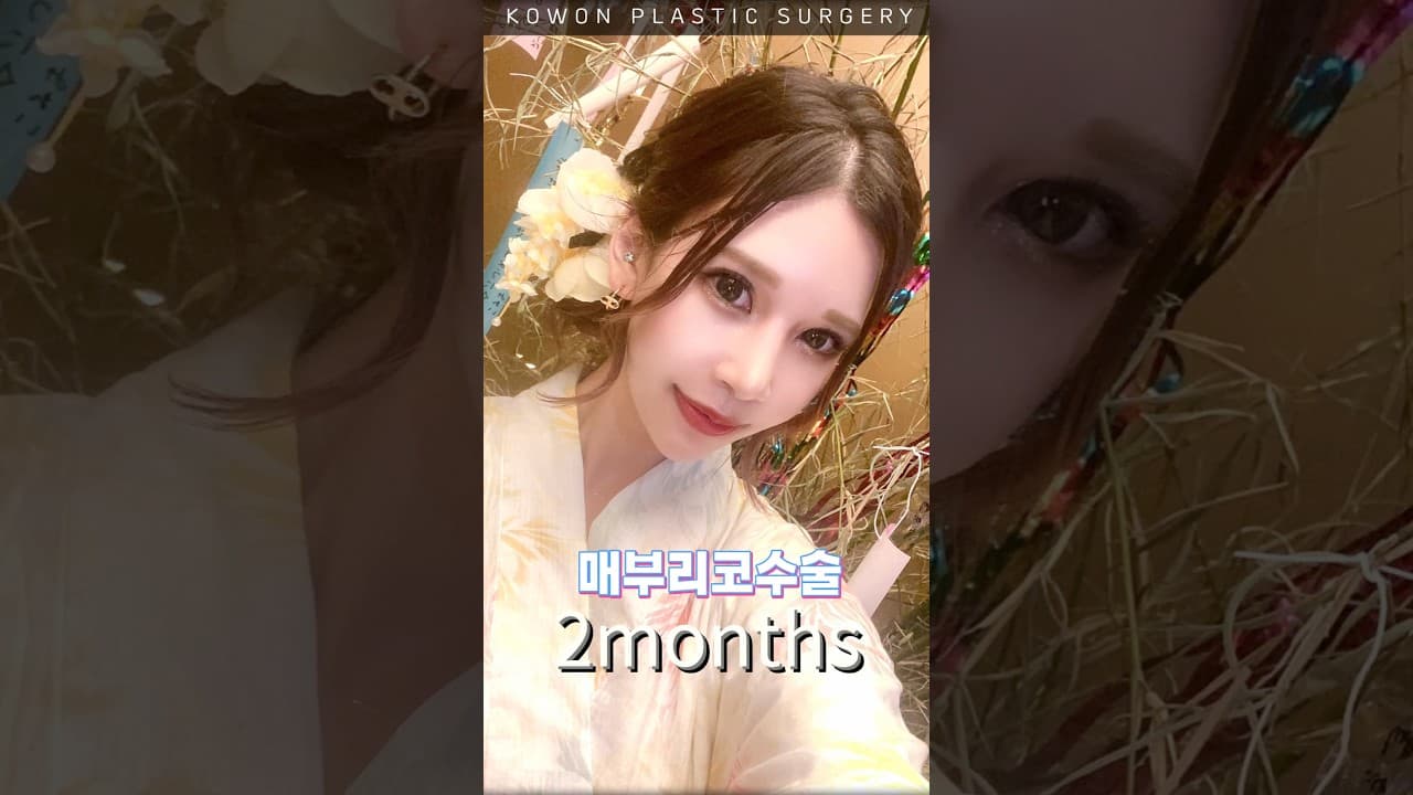 매부리코·콧볼·비염, 동시에 교정할 수 있을까?