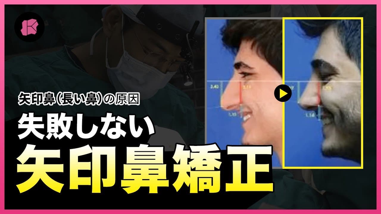 矢印鼻（長い鼻）を矯正する確実な方法とは？👃