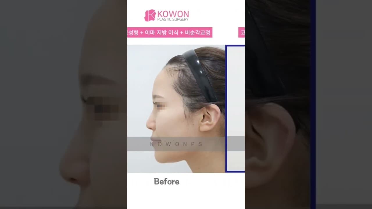 인형처럼 예쁜 얼굴의 비밀!