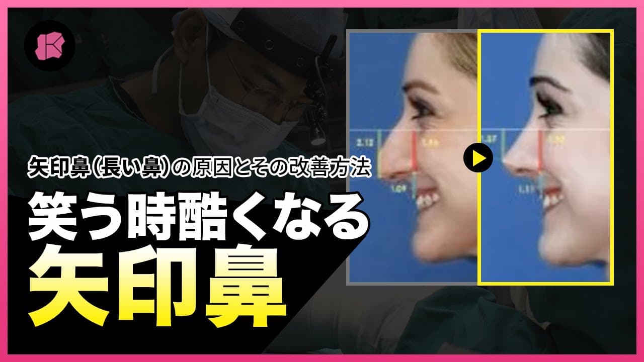 矢印鼻（長い鼻）再手術したく無い方は必ず視聴！👃矢印鼻の原因と手術方法