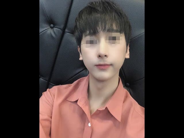 코원성형외과 코 성형 ★Before & After★