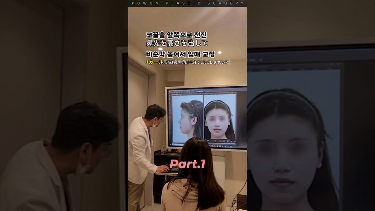 part.1 코수술 후 경과 브리핑 (코교정 전 후 설명)매부리코+비순각(입매라인)+퍼진코 코끝 교정