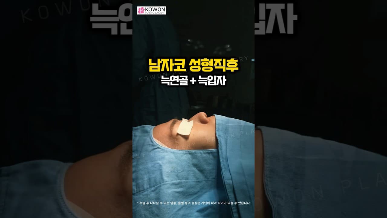남자 코, 콧대만 높이면 더 부자연스럽다고? 처진 코끝+꺼진 미간 동시 교정