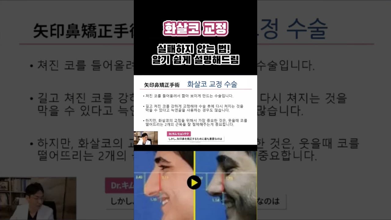 화살코👃 교정 실패하지 않는 법! 알기 쉽게