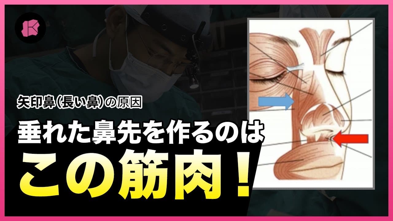 矢印鼻（長い鼻）にさせる筋肉があります！👃矢印鼻の原因