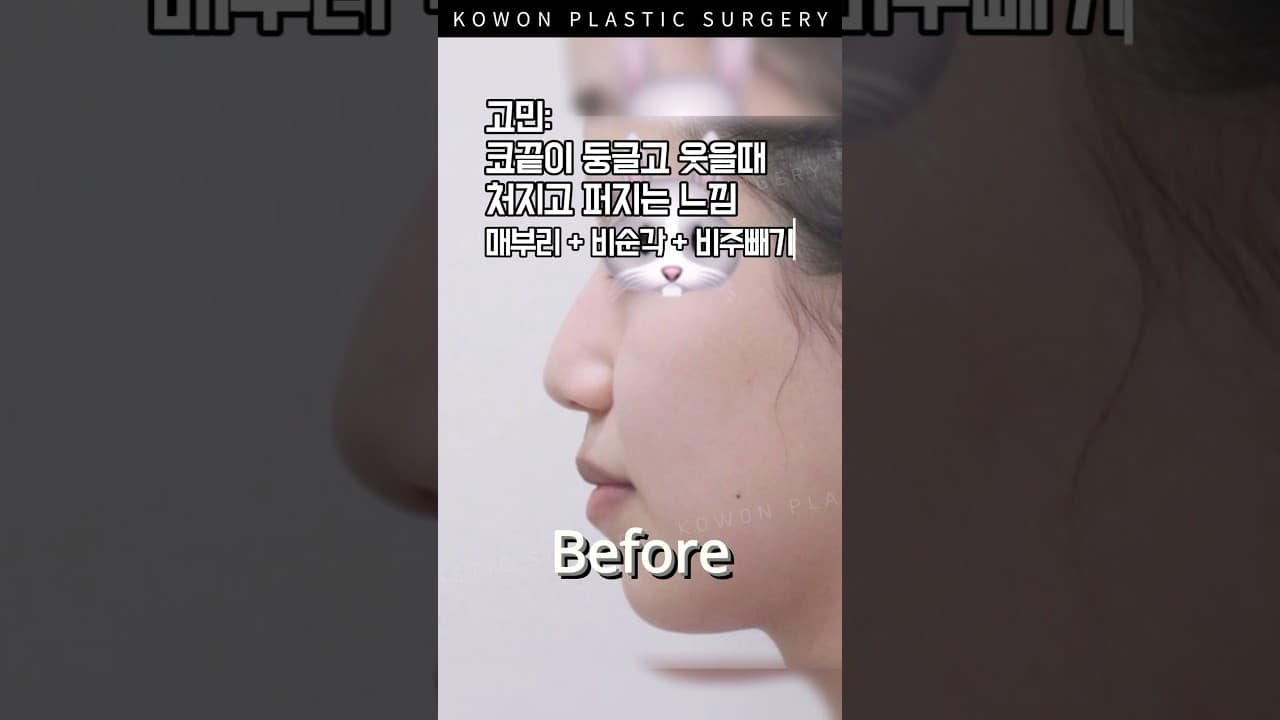 무너지던 코끝 올려줬더니?