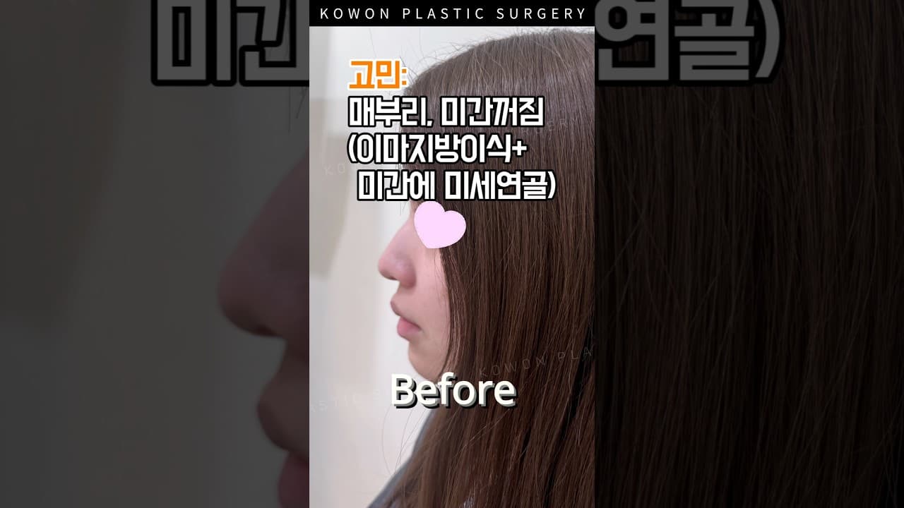 예쁜데… 더 예뻐질 수 있다고?