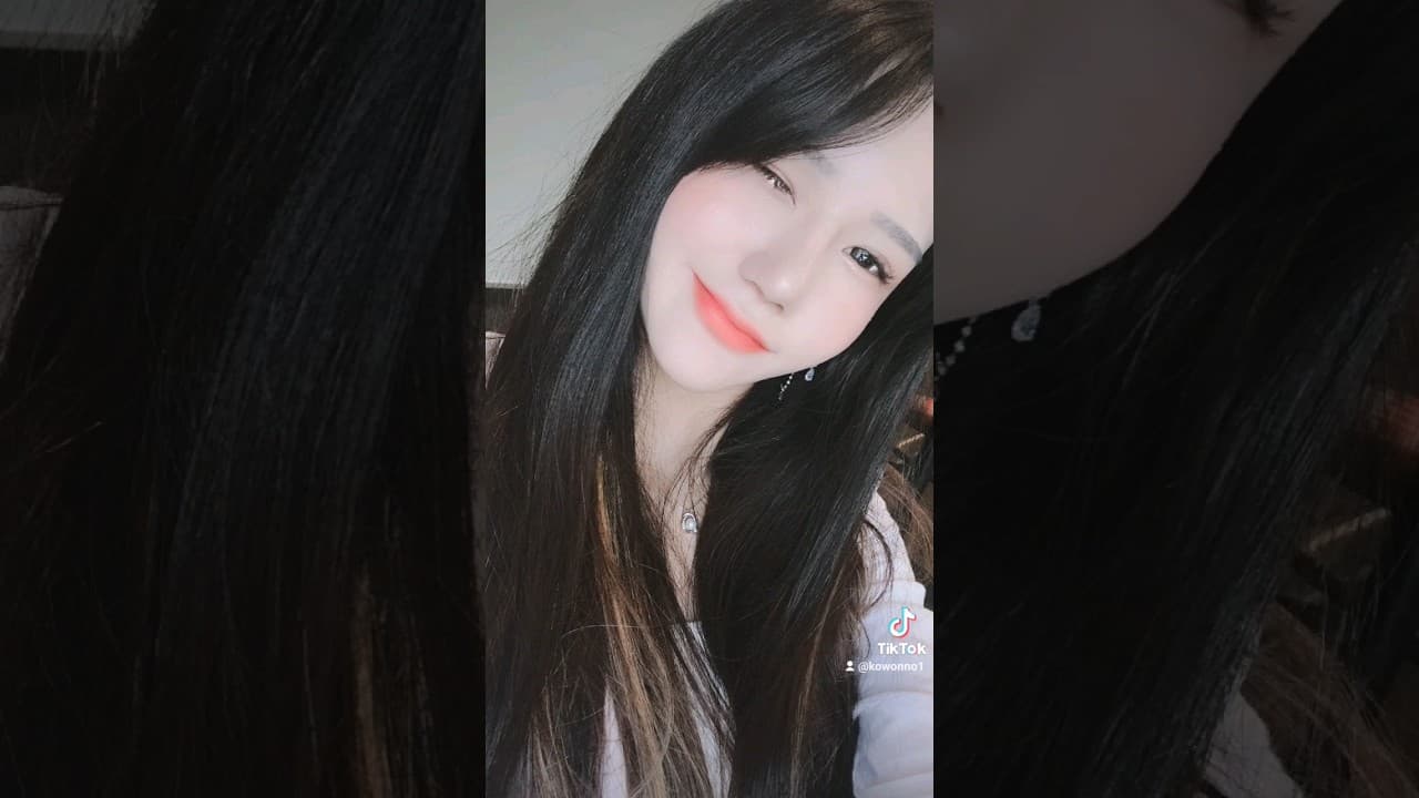복코수술 후기 Bulbous Nose plastic surgery before and after
