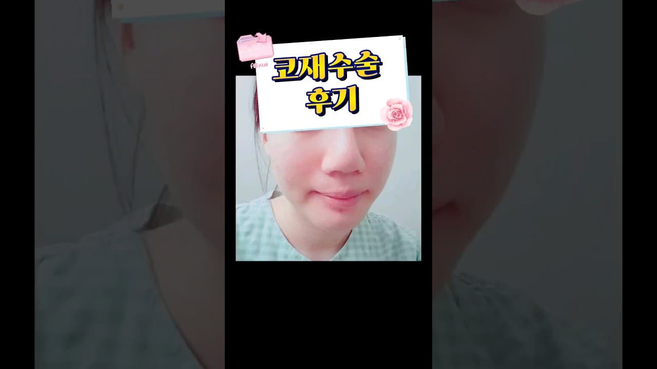 코재수술 후기 | 코첫수술 부작용 후 코원에서 재수술