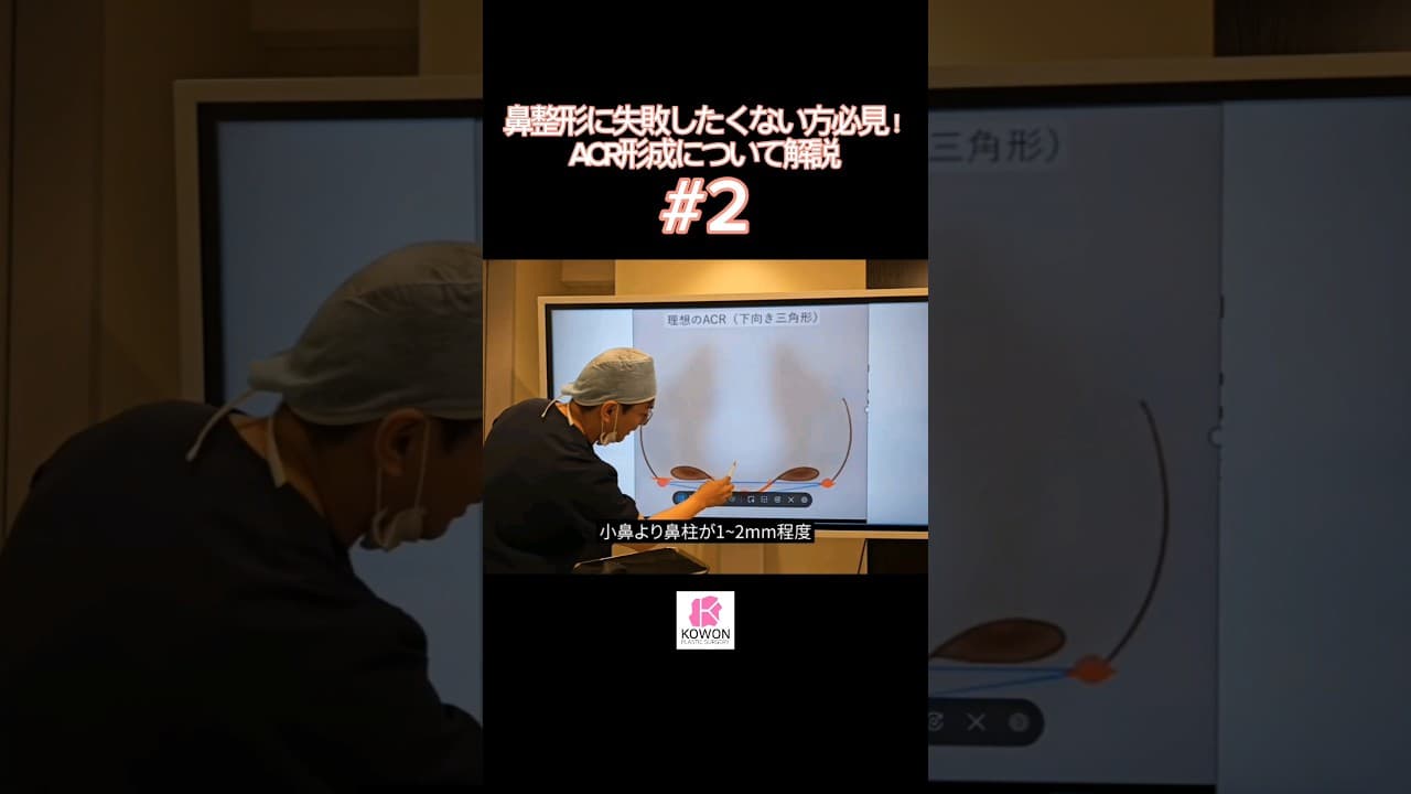 Part.2 鼻整形に失敗したくない方必見！鼻整形の仕上がりを左右するACR形成について解説