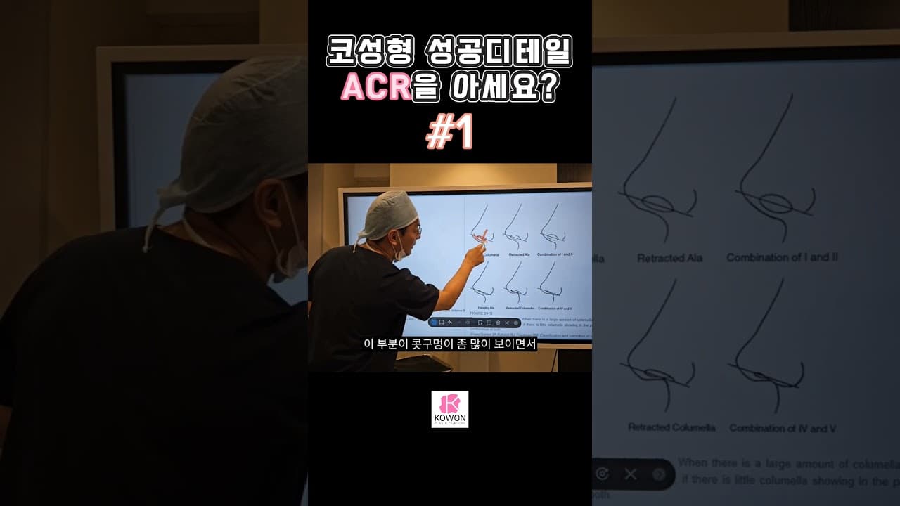 Part.1 코성형성공디테일, ACR을 아세요? 비주와 비순각라인 , 코모양과 입술모양의 관계
