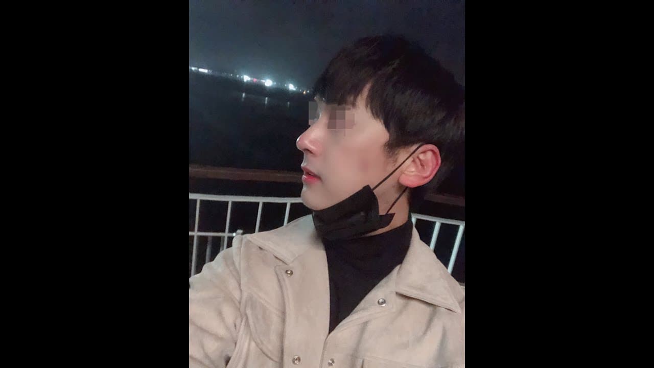 코원성형외과 코 성형 ★Before & After★
