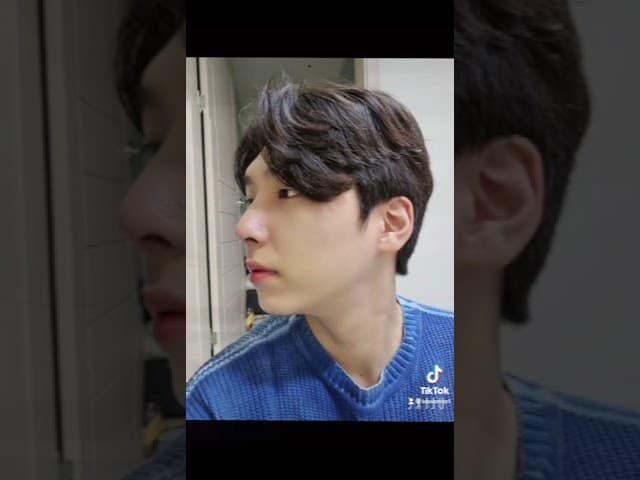 코원성형외과 코 성형 ★Before & After★_매부리코