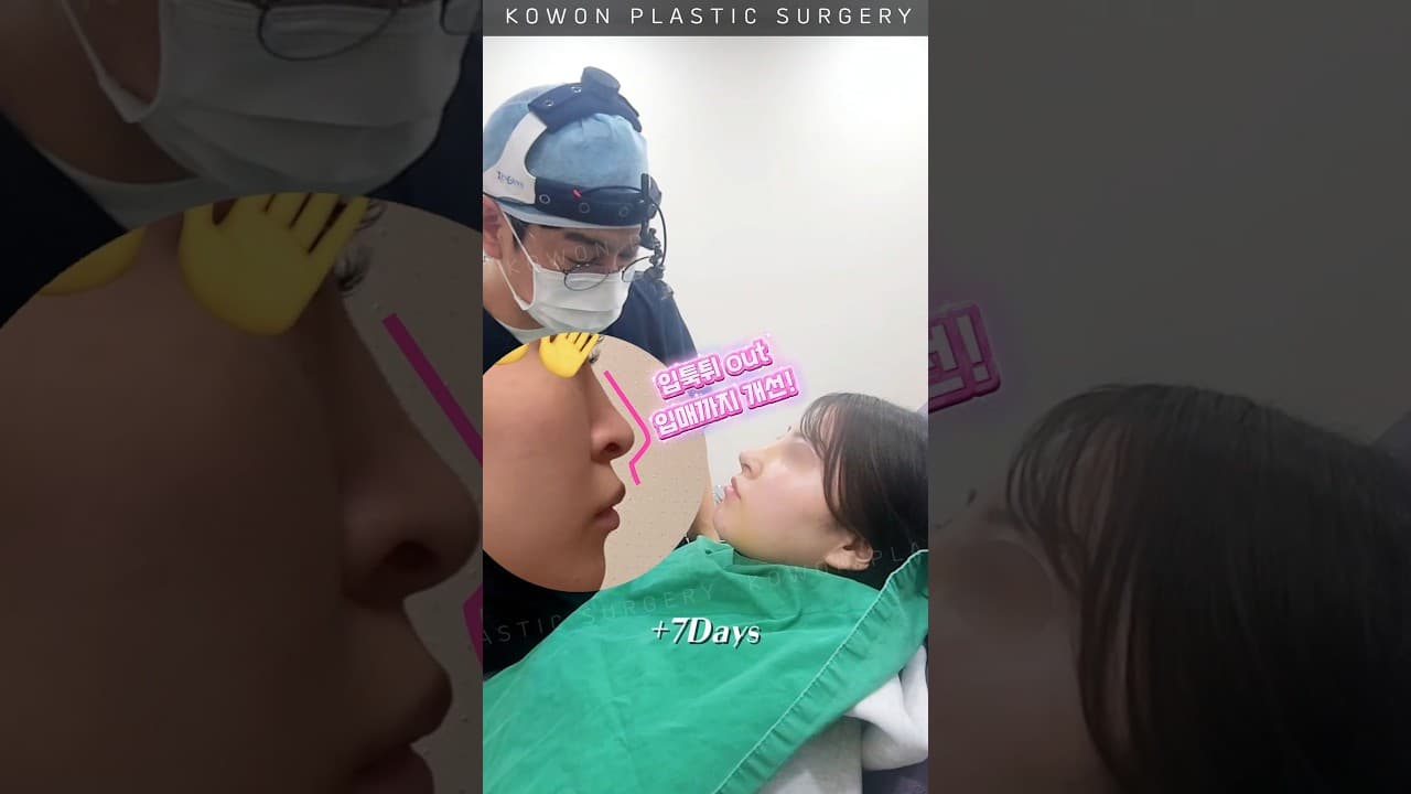 용코+화살코 수술했더니?