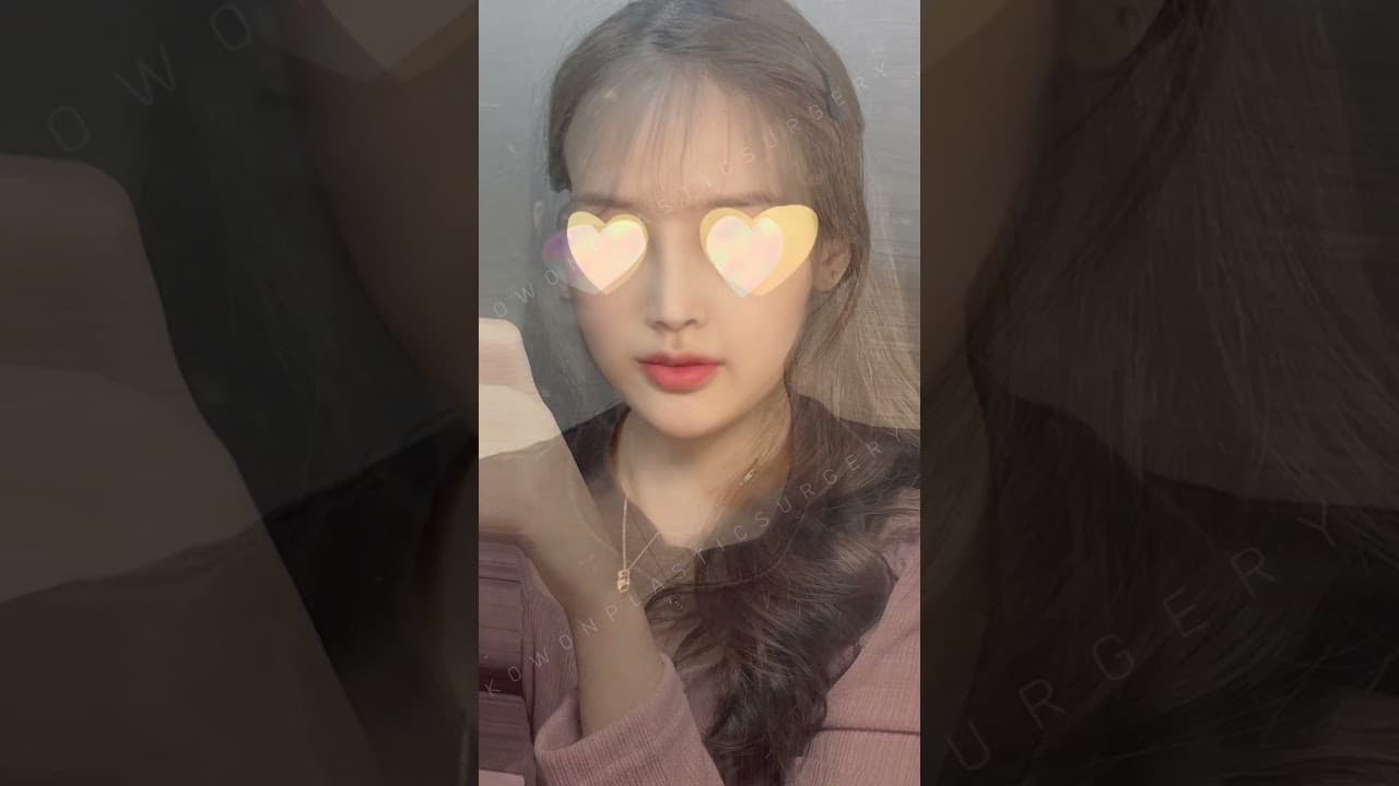 🎥 Before & After: 코 각도가 얼굴 균형에 미치는 영향 (낮은코교정)