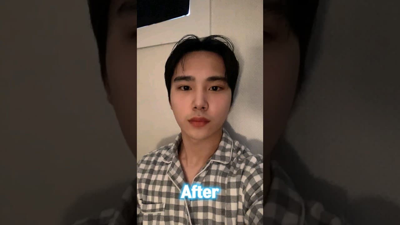 남자 코수술후기 | 매부리코와 뭉툭한코 날렵해지고 싶어요(わし鼻と団子鼻、シュッとした鼻になりたい。)