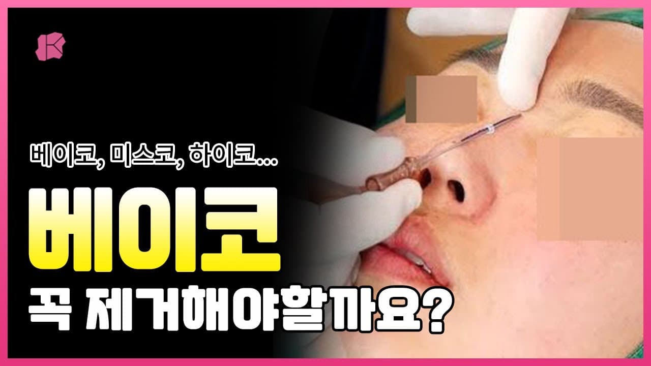 코시술 후 부작용이 생겼어요! | 베이코 하이코 코성형 실&코필러 제거
