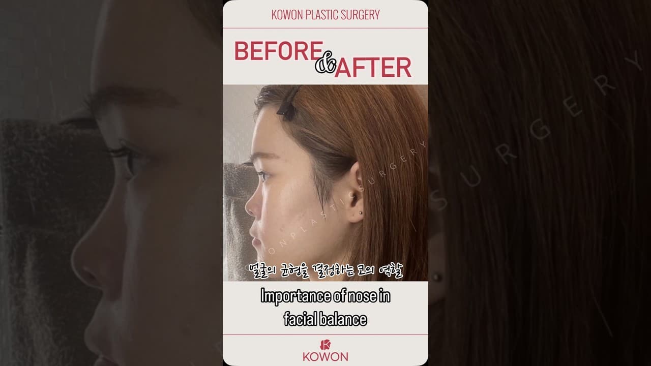 📏 조화로운 옆라인 만들기: 낮은코 비포 & 애프터 변화