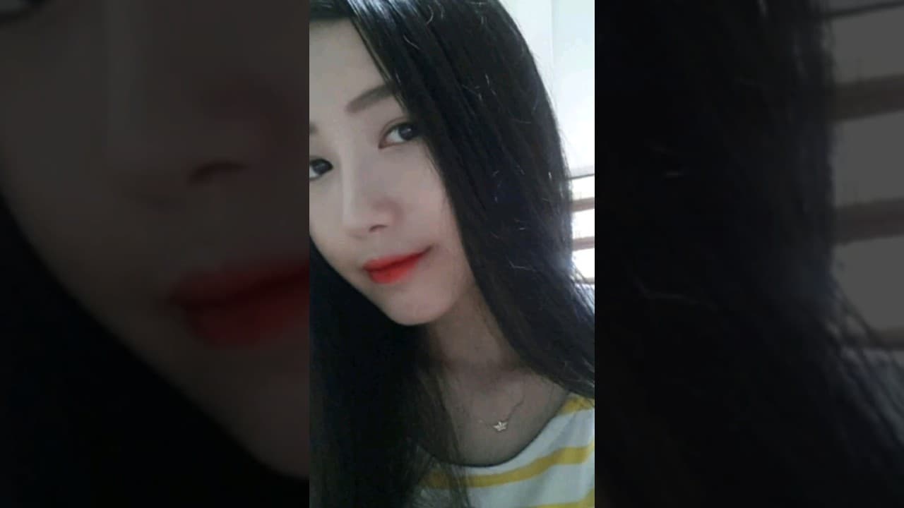 코원성형외과 | 코수술 코성형 전 후 (Kowon Plastic Surgery Before and After Nose Surgery)