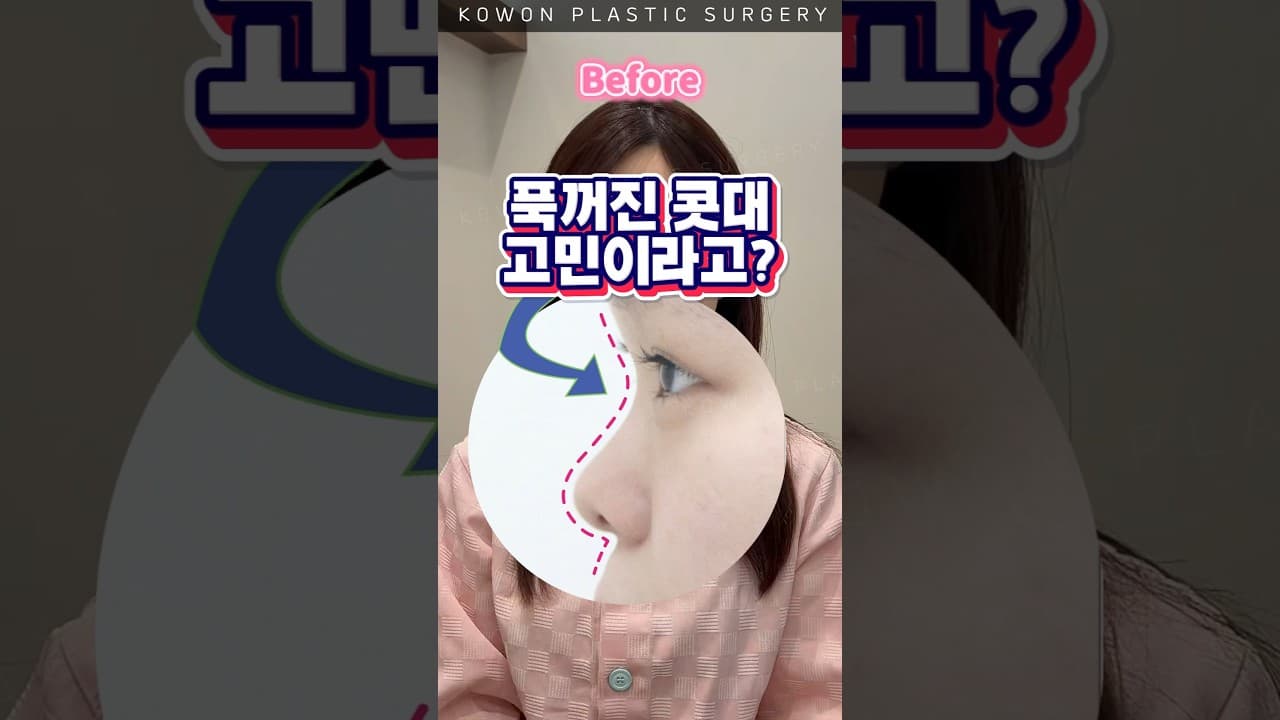 내 얼굴, 왜 밋밋해 보였는지 이제야 알았다