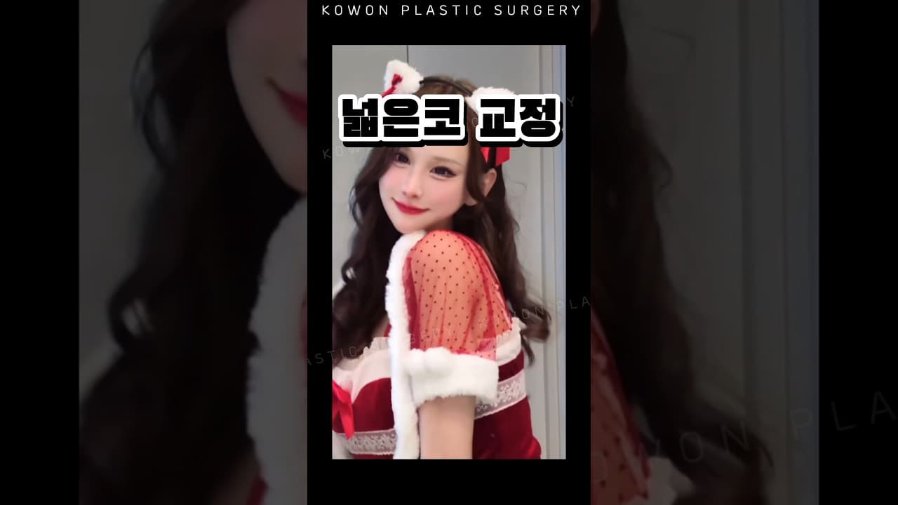 원래 예뻤지만, 코원의 넓은 코 교정으로 더 예뻐짐