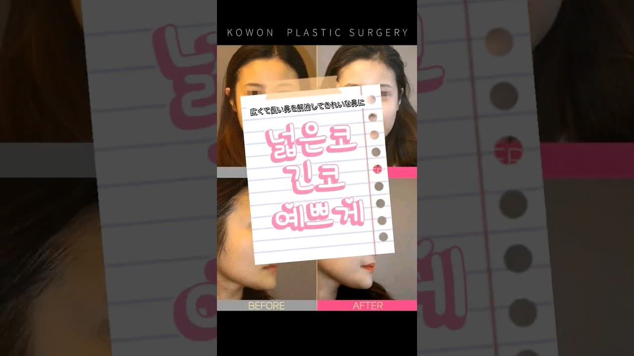 넓은코, 긴코 고민인가요?