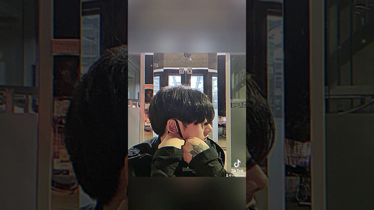 코원성형외과 코 성형 ★Before & After★