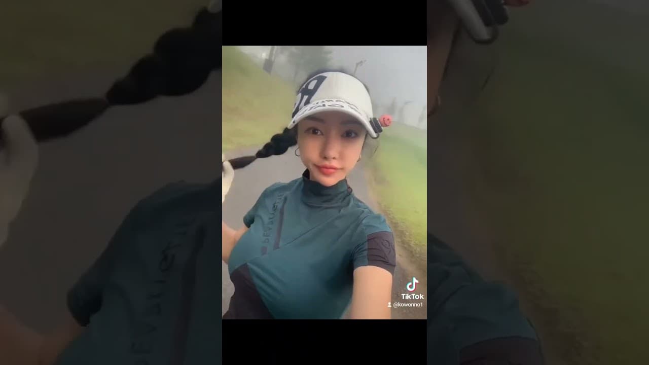 코 재수술로 굵어 보이는 콧대와 코끝 떨어짐 문제 해결!