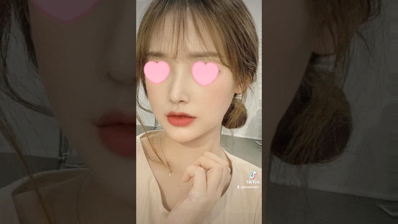 낮은코수술 후기 | 코수술하니 확실히 얼굴이 입체적으로 보여요 (#낮은코 #화살코) 低い鼻整形手術前後 | 鼻手術をすることで立体感や小顔効果が得られました！
