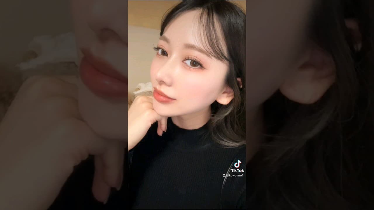 코원 코수술 전 후 한달차 경과 (비중격+비순각+실리프팅)