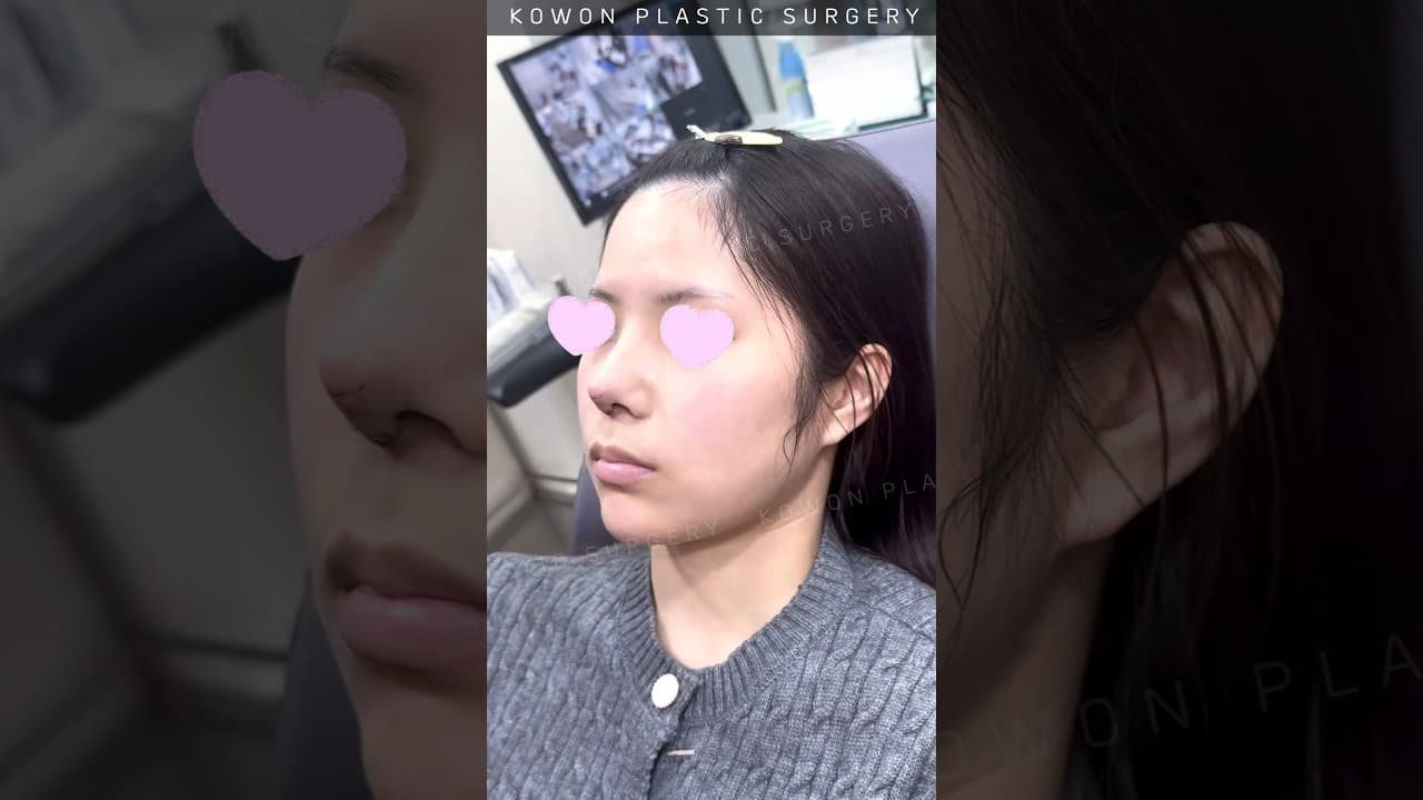 코수술, 자연스럽게 가능할까?