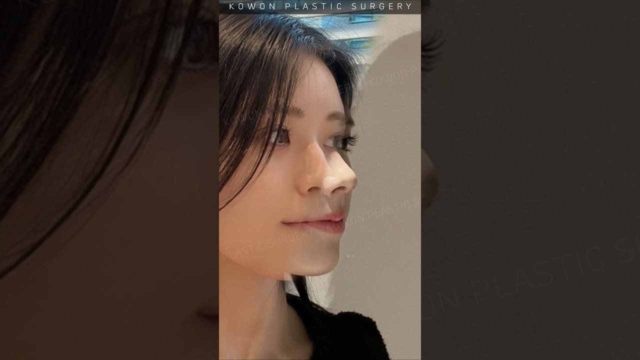 낮은코 매부리코 자연스럽고 예쁜코로