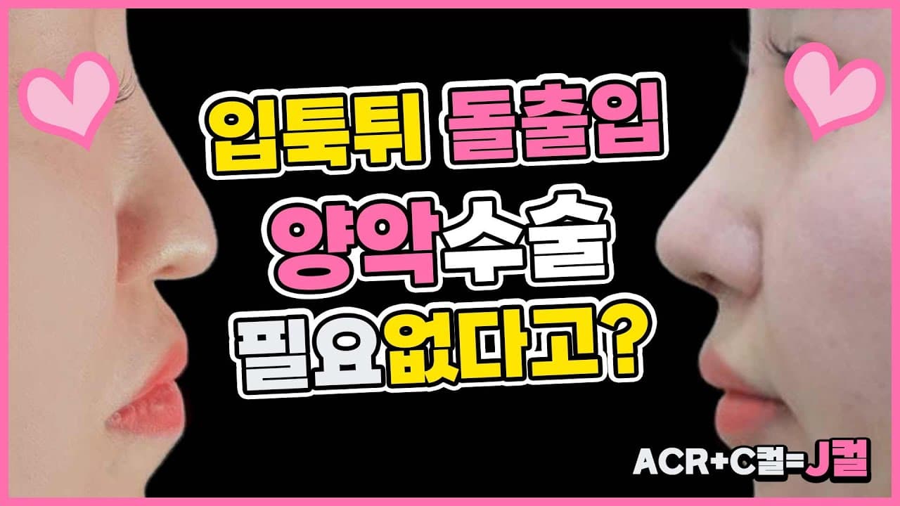 입툭튀 돌출입수술 절대 하지 마세요 코원 김형택원장이 설명해 드려요