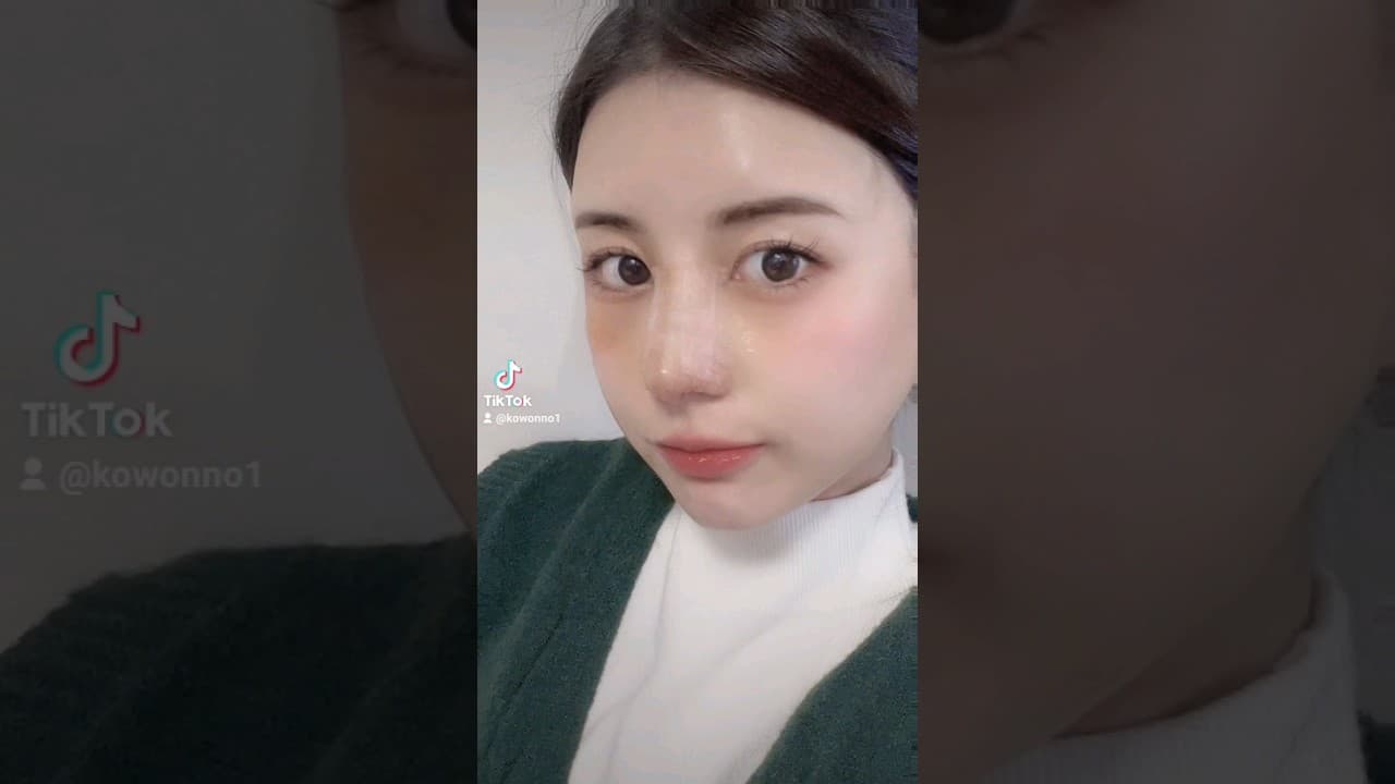 코성형 후기 | 낮고 퍼져보이는 코와 눈과 눈사이가 멀어 고민