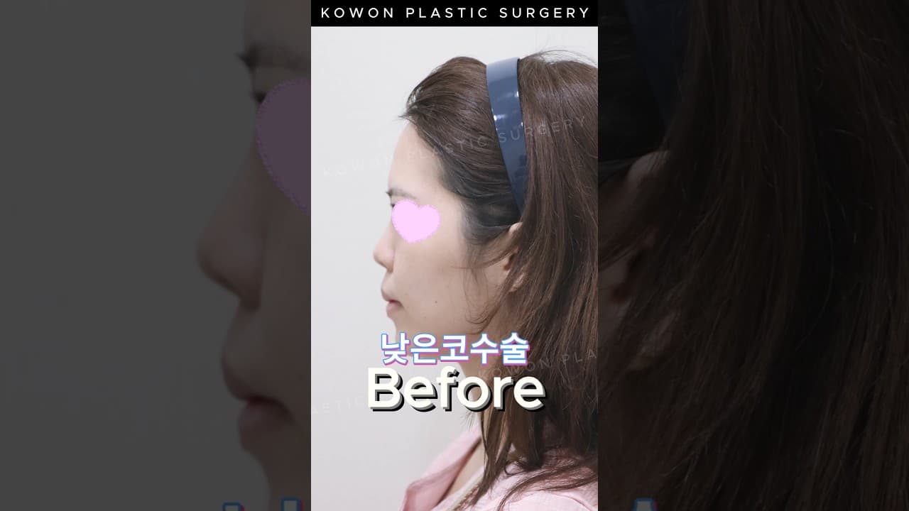 입 나오면 무조건 교정해야 한다구요?