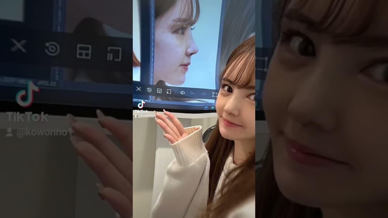 성형티 나지 않는 귀여운코 원래 내 코 였던것처럼 예뻐지기!