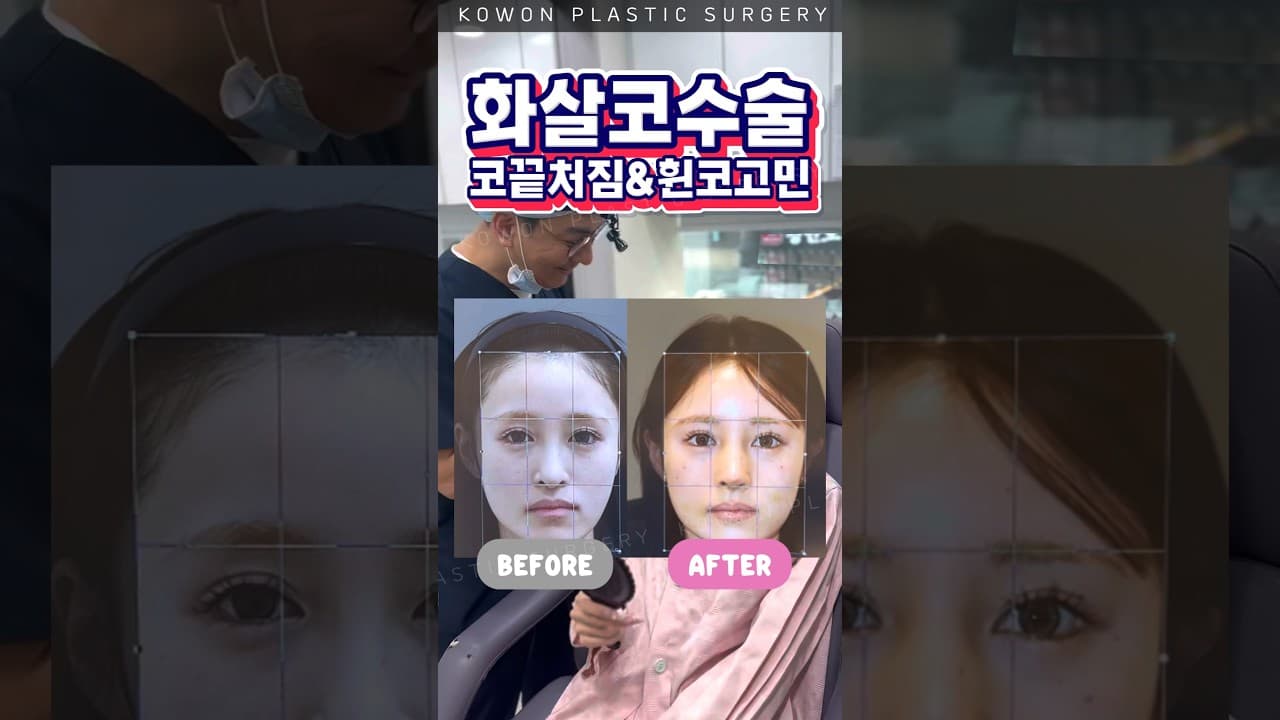 화살코가 이렇게 바뀐다고요?? 단 8일만에 놀라운 변화!