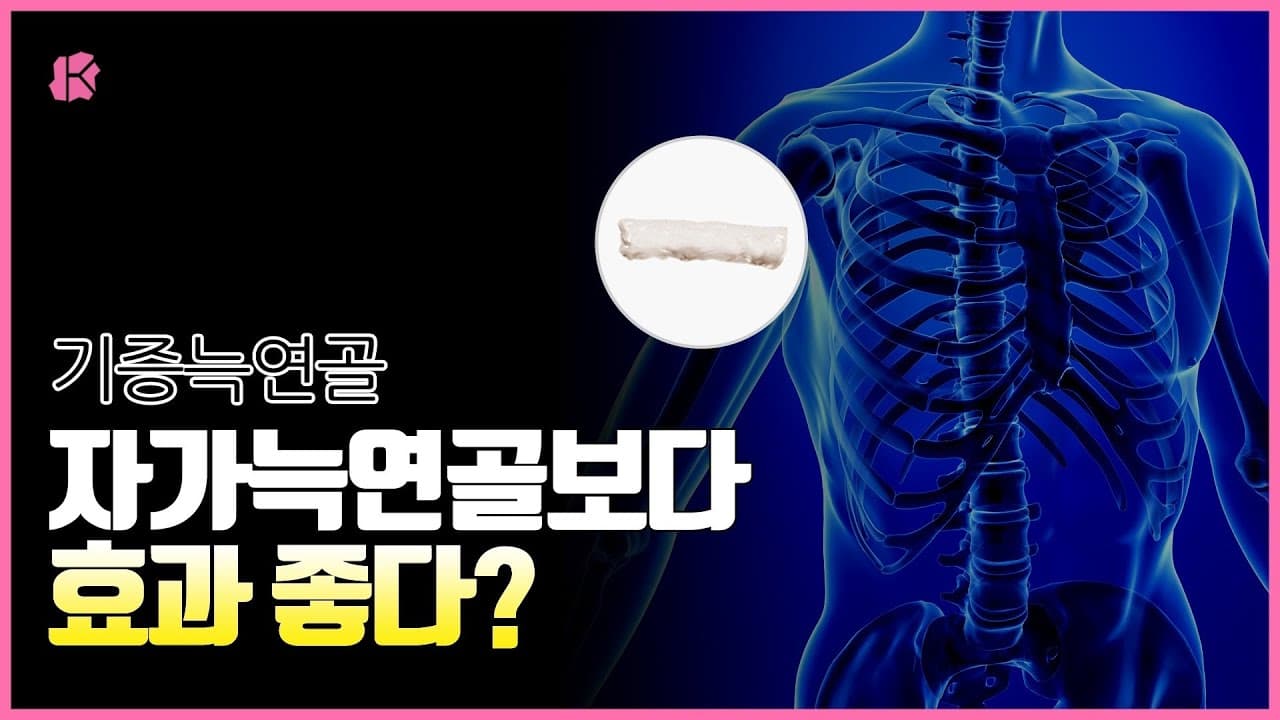 기증늑연골, 자가늑연골보다 효과 좋다!? ｜자가늑연골 & 기증늑연골