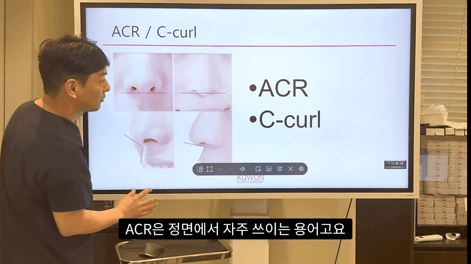 자연스러운 코끝은 왜 사각형일까 — ACR·비순각 90도와 돌출입 완화 효과 관련 이미지 2/35