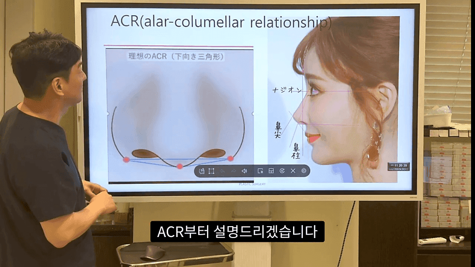 자연스러운 코끝은 왜 사각형일까 — ACR·비순각 90도와 돌출입 완화 효과 관련 이미지 3/35