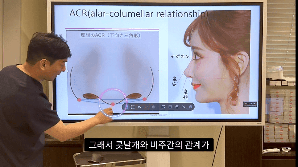 자연스러운 코끝은 왜 사각형일까 — ACR·비순각 90도와 돌출입 완화 효과 관련 이미지 4/35