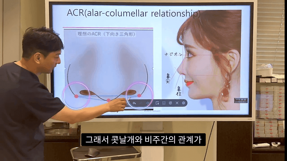 자연스러운 코끝은 왜 사각형일까 — ACR·비순각 90도와 돌출입 완화 효과 관련 이미지 5/35