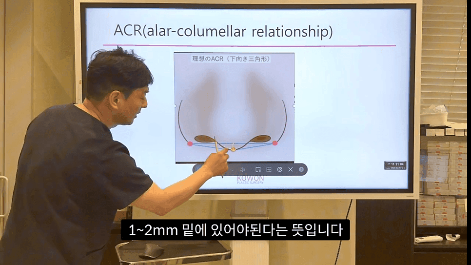 자연스러운 코끝은 왜 사각형일까 — ACR·비순각 90도와 돌출입 완화 효과 관련 이미지 7/35